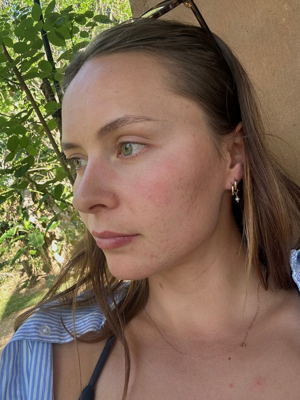 After Clear Skin Club